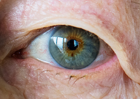 Retina